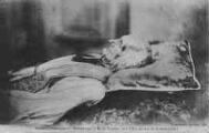 1 vue Légende inscrite sur la carte postale : Portrait authentique du Bienheureux J.-M.-B. VIANNEY, curé d Ars, sur son lit de mort (1859) 5 Fi 21-137